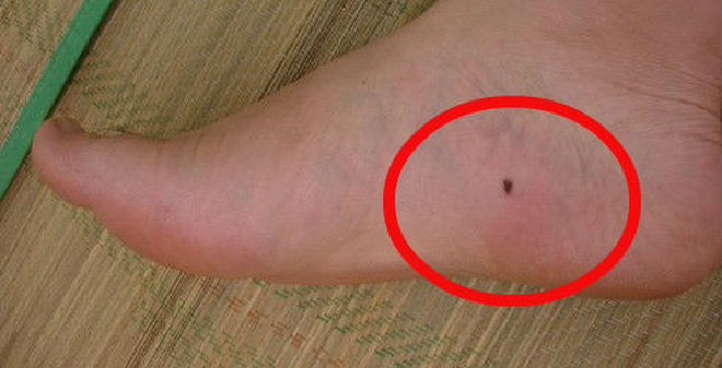 Nhìn ngay xuống bàn chân nếu sở hữu 4 điểm này là bạn có phúc tướng trời cho, cả đời tha hồ hưởng phước