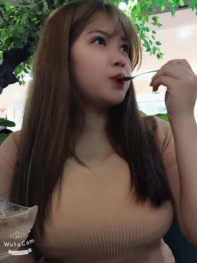 Hình ảnh mới nhất của nữ sinh có vòng 1 khủng sau phẫu thuật hút 6 lít mỡ khỏi cơ thể