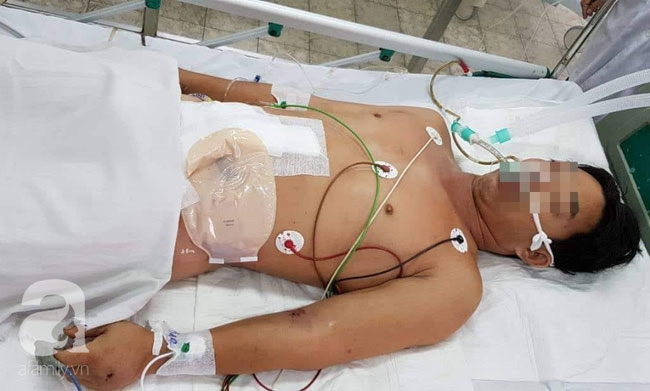 Người đàn ông ở Đồng Nai bị cắt ngang bụng, thủng ruột kinh hoàng do máy cưa vướng vào áo