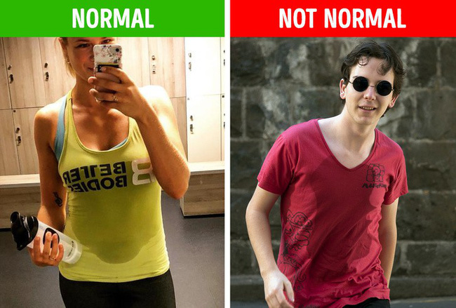 Đừng cố tình bỏ qua 6 biểu hiện ở nách vì nó có thể chỉ ra bệnh tiềm ẩn, không ngoại trừ ung thư