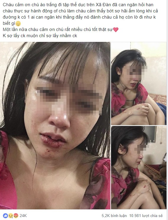 Cô gái xinh đẹp, bức ảnh môi bầm dập và dòng tâm sự cay đắng thu hút 11.000 lượt chia sẻ