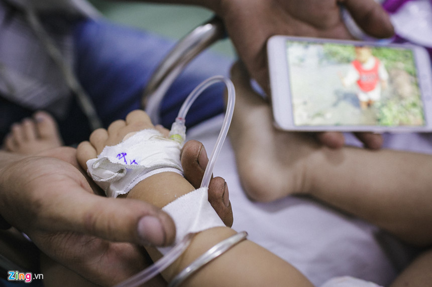 Bệnh viện nhi đồng ở Sài Gòn vỡ trận vì dịch chồng dịch Bệnh viện nhi đồng ở Sài Gòn vỡ trận vì dịch chồng dịch