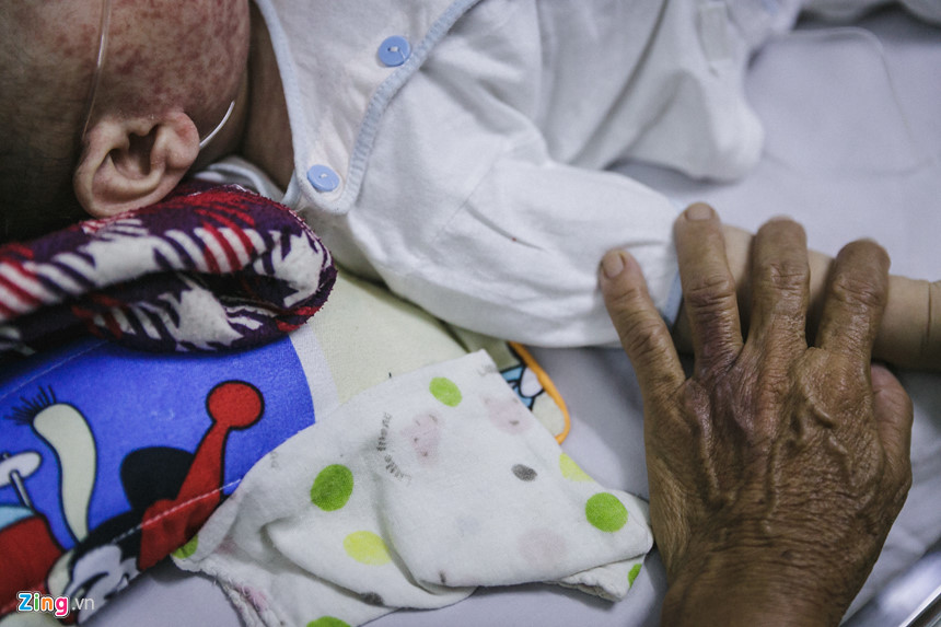 Bệnh viện nhi đồng ở Sài Gòn vỡ trận vì dịch chồng dịch Bệnh viện nhi đồng ở Sài Gòn vỡ trận vì dịch chồng dịch