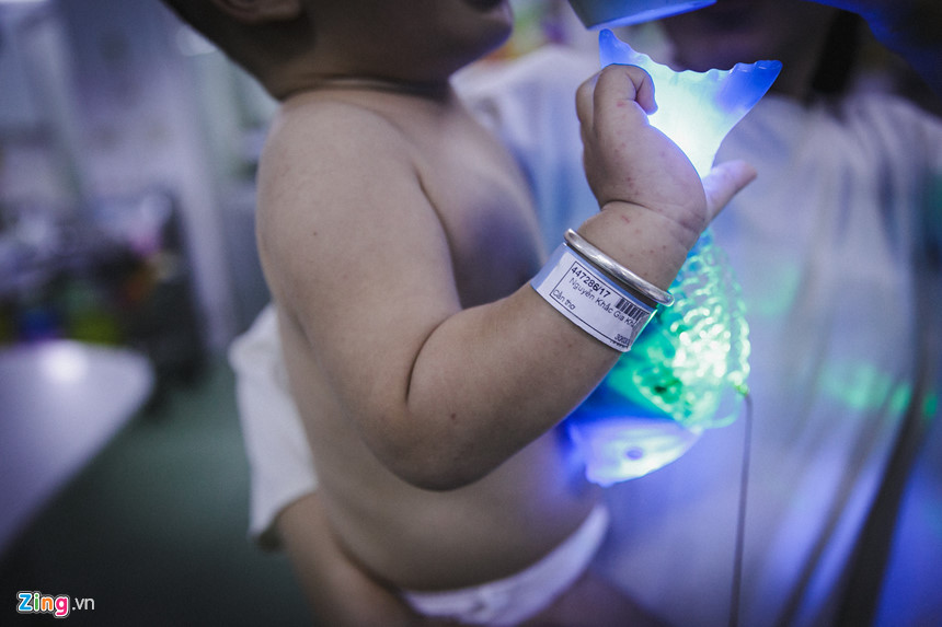 Bệnh viện nhi đồng ở Sài Gòn vỡ trận vì dịch chồng dịch Bệnh viện nhi đồng ở Sài Gòn vỡ trận vì dịch chồng dịch