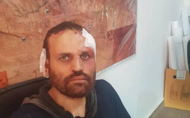 Kích nổ áo bom tự sát nhưng bất thành, thủ lĩnh khủng bố khét tiếng của Al-Qaeda bị bắt sống