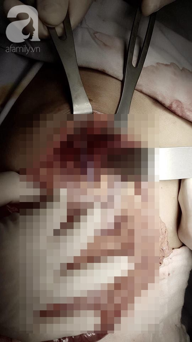 Bé trai 7 tuổi nôn ra đầy bát máu vì căn bệnh vô cùng hiểm ác