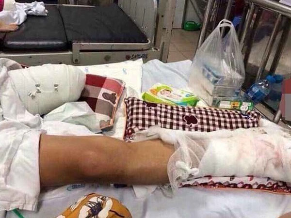 Vụ thanh niên bị truy sát chém nát chân: Nghi do mâu thuẫn trong hoạt động cho vay tín dụng đen