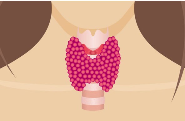 Cuộc sống đầy khủng hoảng của những phụ nữ bị bệnh tuyến giáp: Mất kinh nguyệt, tăng 20kg trong 2 tháng... và dấu hiệu cảnh báo cần đi khám ngay