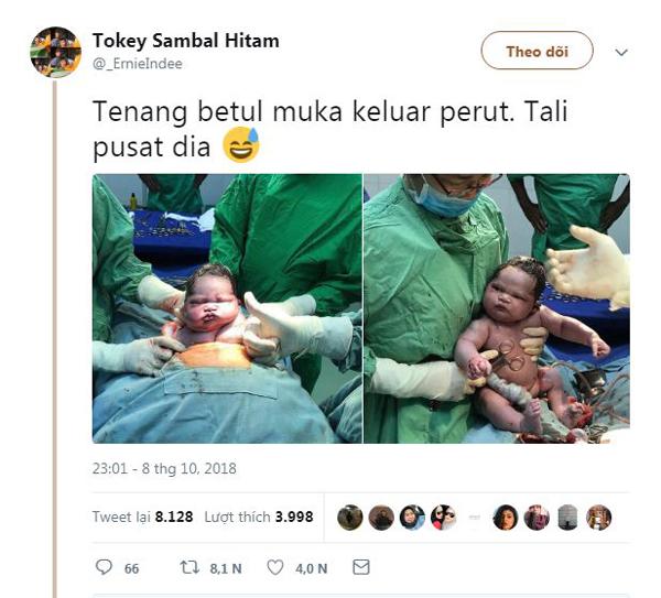 Em bé gây bão vì chào đời không thèm khóc, chưng ngay vẻ mặt: Sao lại lôi cháu ra đây!