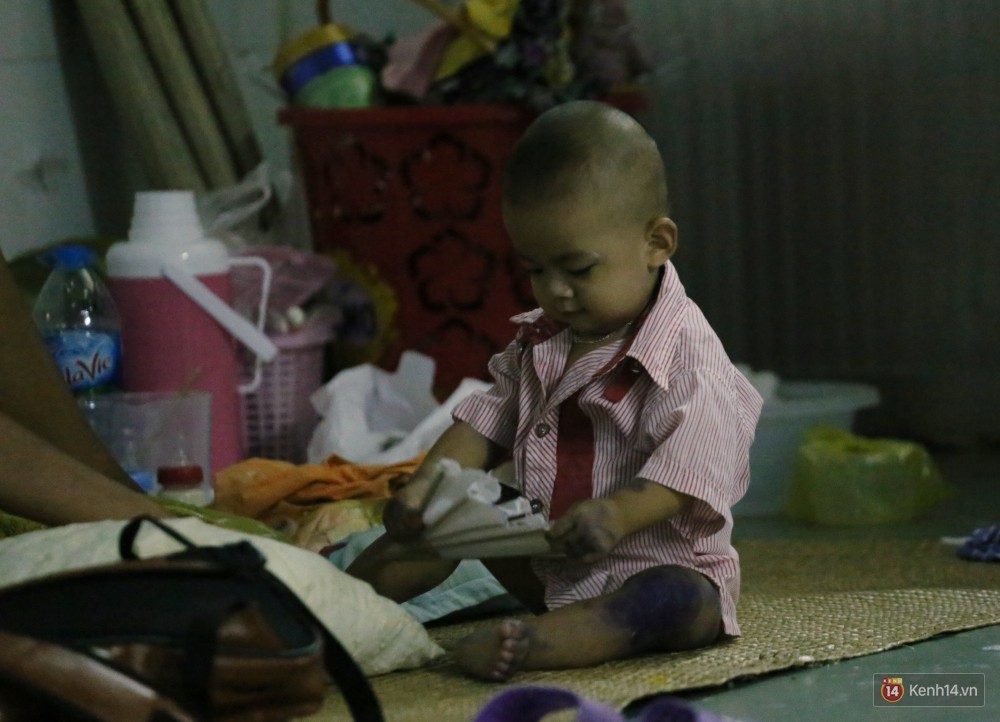 Dịch tay chân miệng bùng phát khó lường ở Sài Gòn: Bệnh viện quá tải, bố mẹ trắng đêm chăm con