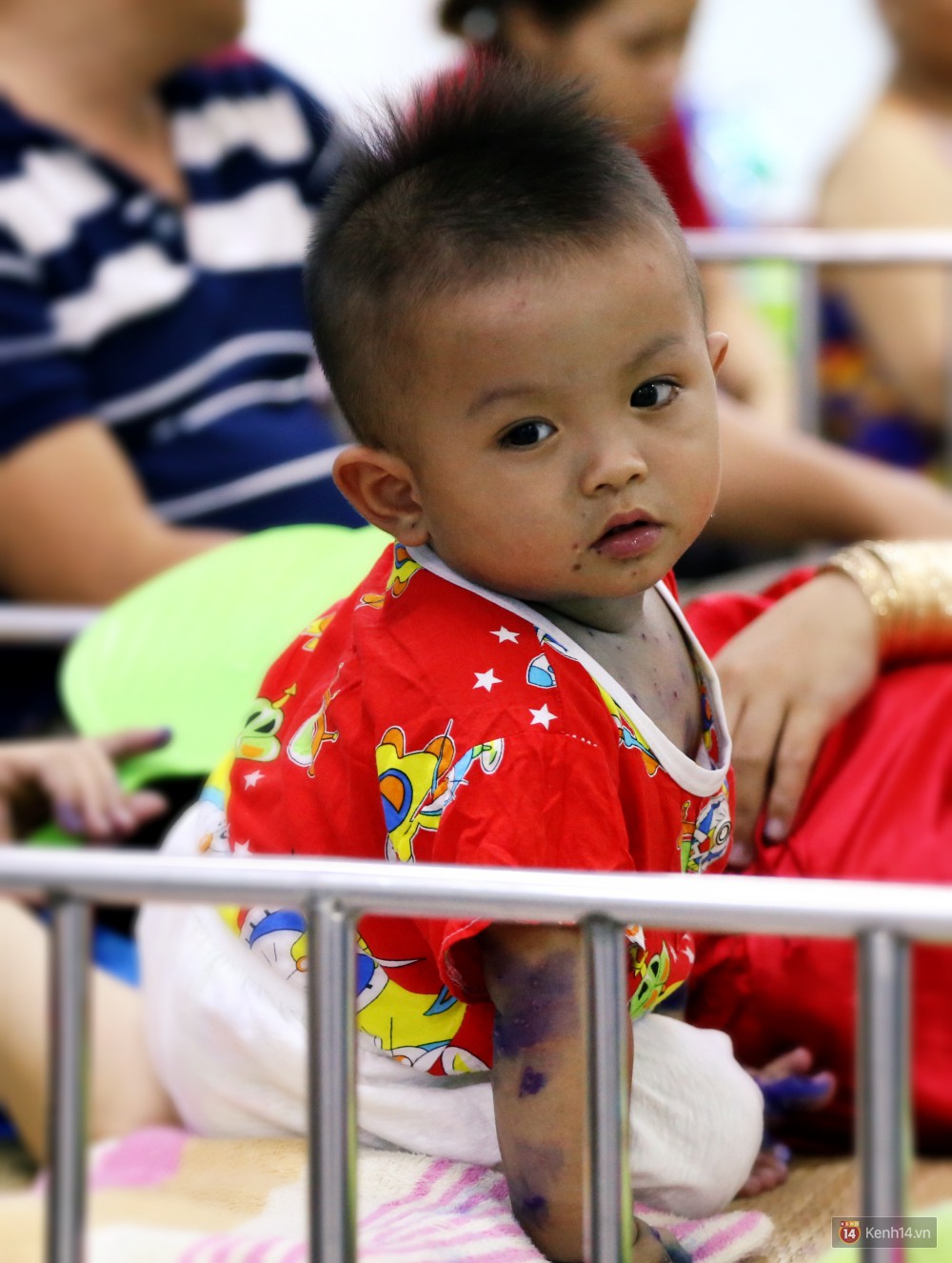 Dịch tay chân miệng bùng phát khó lường ở Sài Gòn: Bệnh viện quá tải, bố mẹ trắng đêm chăm con