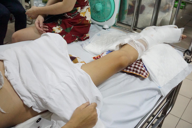 Thanh niên bị nhóm côn đồ truy sát phải cưa chân: Nghi người trong giới làm ăn trả thù