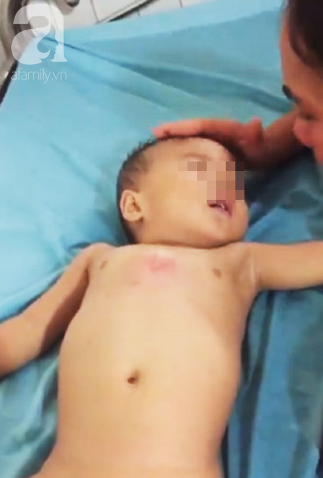 TP.HCM: Mẹ bận bán rau trước nhà, con trai 19 tháng tuổi chúi đầu vào thùng nước ngưng tim