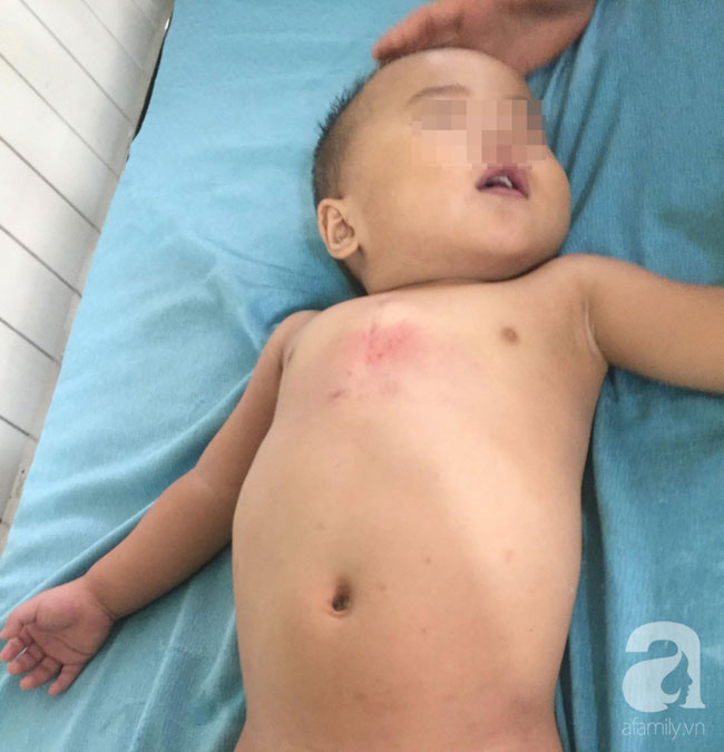 TP.HCM: Mẹ bận bán rau trước nhà, con trai 19 tháng tuổi chúi đầu vào thùng nước ngưng tim