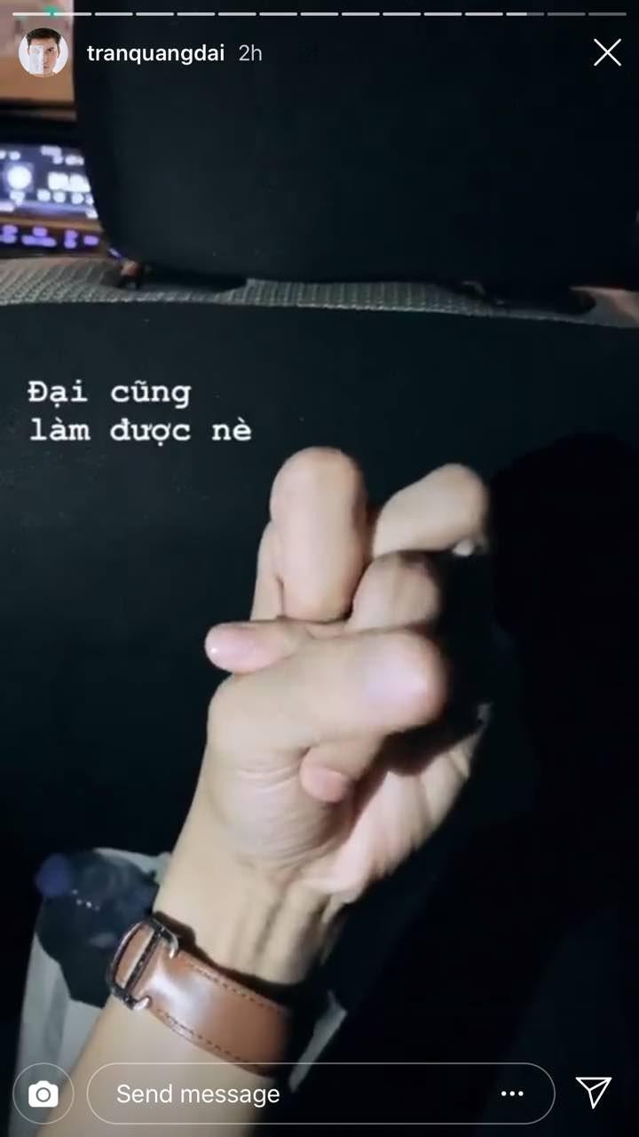 Với trào lưu thắt nút ngón tay mới nổi, chắc chắn não bạn sẽ muốn xoắn quẩy theo