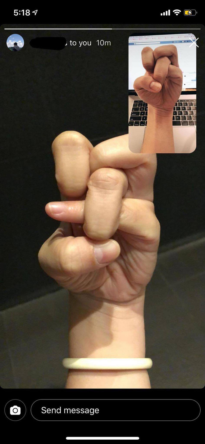 Với trào lưu thắt nút ngón tay mới nổi, chắc chắn não bạn sẽ muốn xoắn quẩy theo