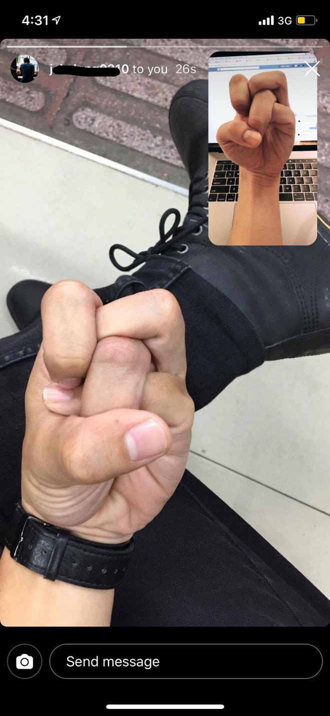 Với trào lưu thắt nút ngón tay mới nổi, chắc chắn não bạn sẽ muốn xoắn quẩy theo