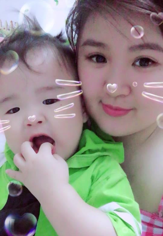 Ủ bệnh 10 ngày, bé trai 20 tháng được phát hiện mắc tay chân miệng nặng nhất bệnh viện