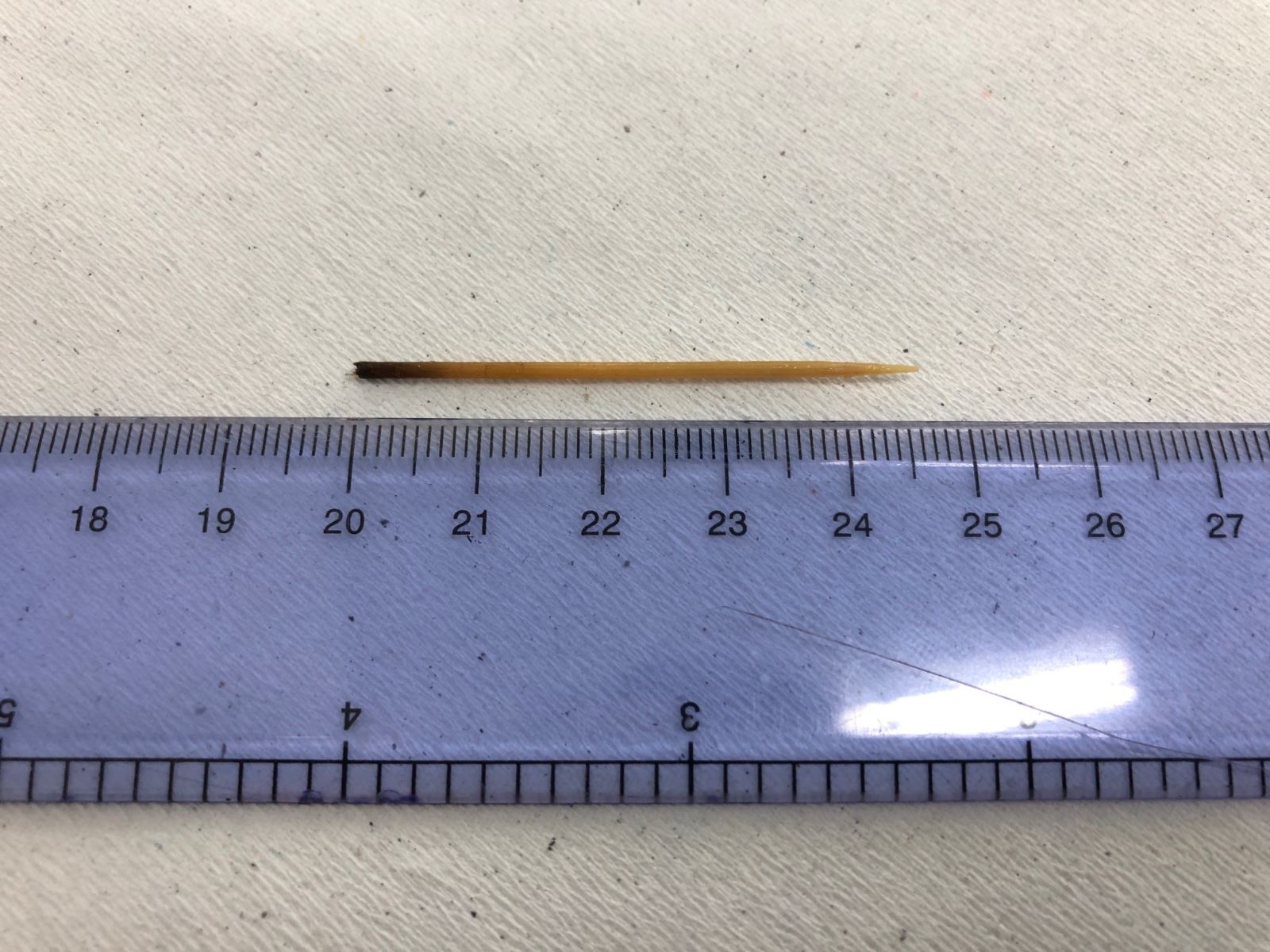 Uống nước khi đang xỉa răng, nam thanh niên bị cây tăm đâm xuyên dạ dày