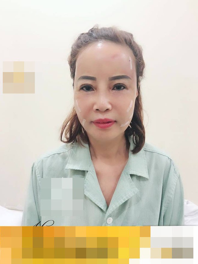 Sau khi đưa chồng trẻ đi nhấn mí, cô dâu 62 tuổi lại gây sốc với gương mặt trẻ ra 20 tuổi nhờ PTTM