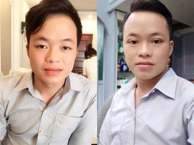 Sau khi đưa chồng trẻ đi nhấn mí, cô dâu 62 tuổi lại gây sốc với gương mặt trẻ ra 20 tuổi nhờ PTTM