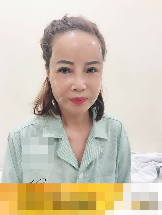Sau khi đưa chồng trẻ đi nhấn mí, cô dâu 62 tuổi lại gây sốc với gương mặt trẻ ra 20 tuổi nhờ PTTM