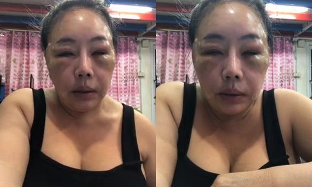 Nữ đại gia 14 đời chồng đã lột xác như gái đôi mươi nhưng lý do cuộc trùng tu nhan sắc này mới thật sự khiến người ta kinh ngạc