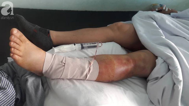 Hải Phòng: Người đàn ông kiệt quệ sau khi bị bạn gái thuê 5 côn đồ truy sát