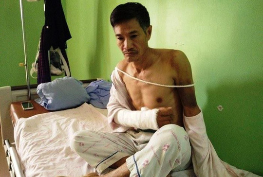 Bị ngăn chặt cây hoa sữa, 8 người xông ra đánh, chém vợ chồng hàng xóm dã man