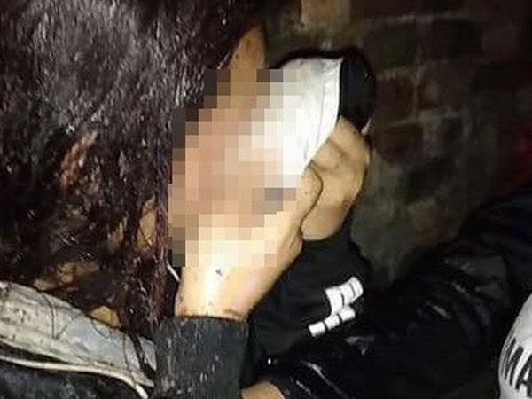 Đánh ghen kinh hoàng bằng mắm tôm trộn nước mắm ở Bắc Ninh: Nhiều lần cảnh cáo?