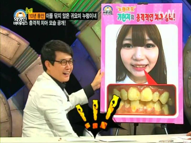 Thánh ở bẩn là có thật: Cô gái 10 năm không đánh răng, bạn trai hôn chưa được 10 giây đã bỏ chạy mất dép