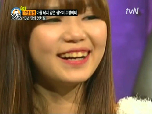 Thánh ở bẩn là có thật: Cô gái 10 năm không đánh răng, bạn trai hôn chưa được 10 giây đã bỏ chạy mất dép