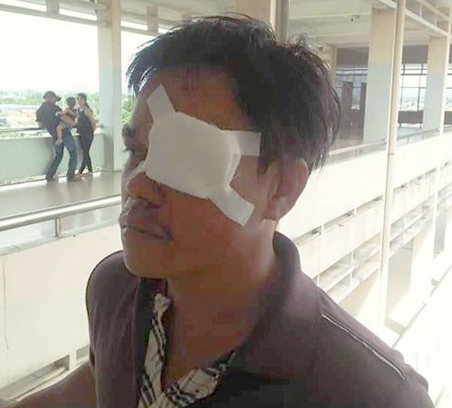 Tín dụng đen bủa vây dân nghèo: Kẻ tự tử, người bị đâm mù mắt