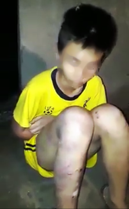 Con học lớp 9 biểu hiện nghiện ma túy, cha nóng giận ra tay đánh đập dã man