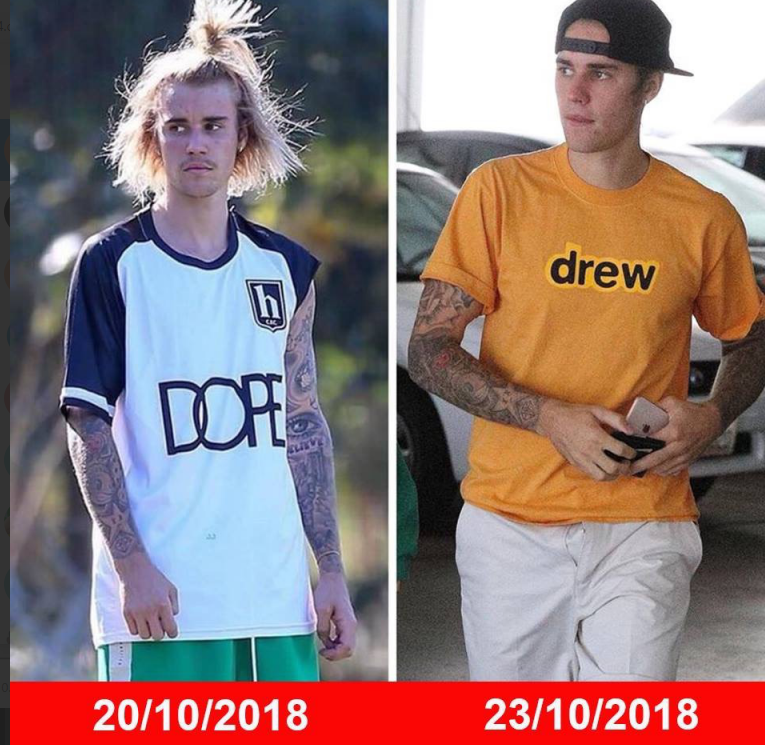 Justin Bieber đã trở lại: Sạch sẽ, bảnh bao, mỗi tội quên kéo khoá quần