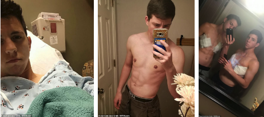 Hành trình của 2 chị em sinh đôi cùng nhau chuyển giới để trở thành anh em trai