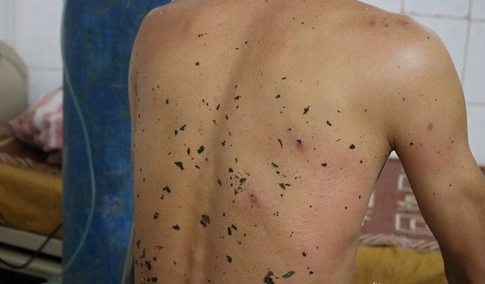 Vào núi lấy củi bất ngờ bị ong rừng tấn công, 1 người chết, 10 người bị thương