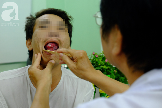 Từ 1 vết loét nhỏ trong miệng, chàng trai 19 tuổi bàng hoàng khi biết mình là bệnh nhân trẻ nhất bị ung thư lưỡi