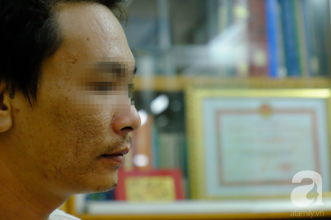 Từ 1 vết loét nhỏ trong miệng, chàng trai 19 tuổi bàng hoàng khi biết mình là bệnh nhân trẻ nhất bị ung thư lưỡi