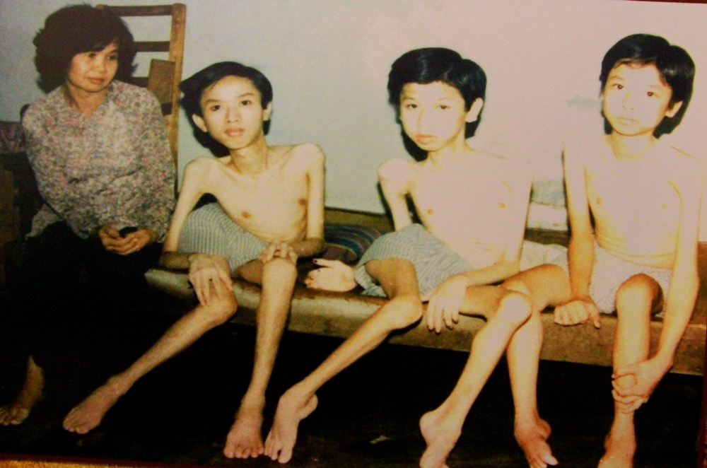 Nỗi đau da cam di truyền qua bốn thế hệ người Việt