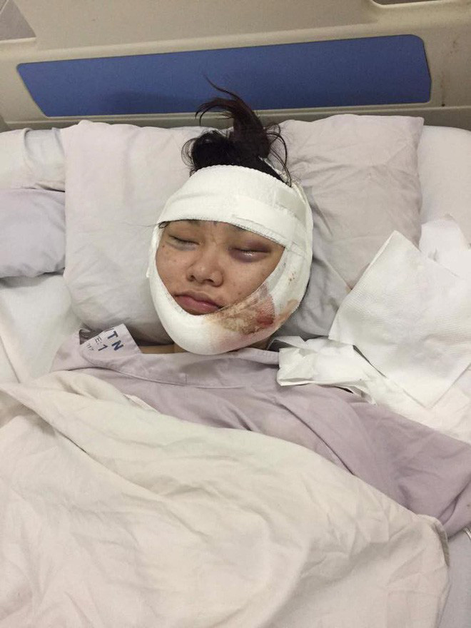 Kiều Anh Hera trở lại với vẻ ngoài xinh đẹp, gợi cảm sau khi lộ ảnh mặt sưng phù vì PTTM