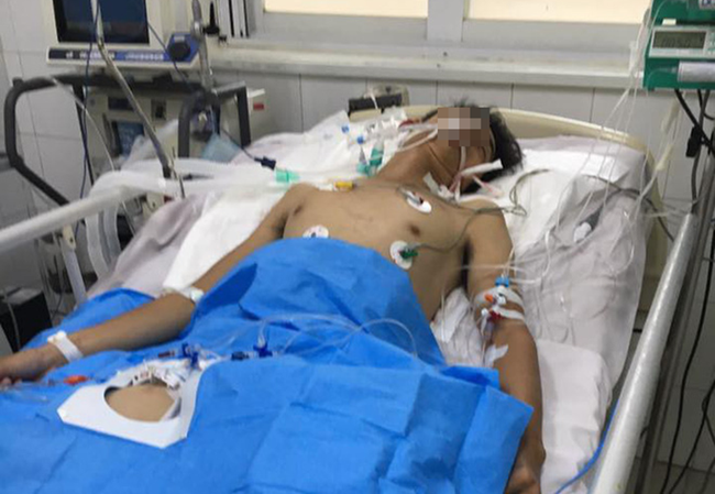 Đang đá bóng thì mưa lớn, người đàn ông bị sét đánh khó tỉnh lại