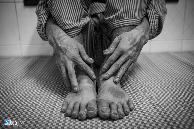 Căn bệnh khiến 2 triệu người Việt sống trong cảnh nhiều lần muốn tự tử