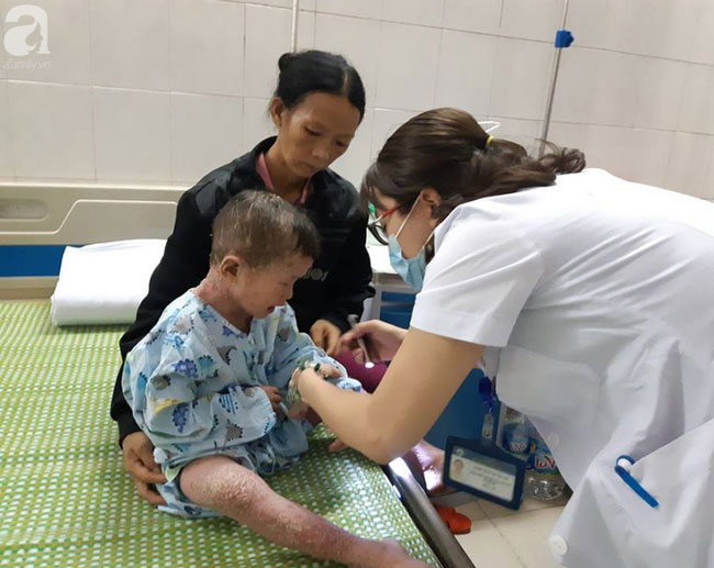 10 ngày thay đổi kỳ diệu của cậu bé người cóc chốn rừng núi xuống Hà Nội chữa bệnh