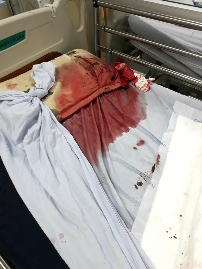 Bức hình máu me gây ám ảnh và câu chuyện đau lòng từ một người bác sĩ