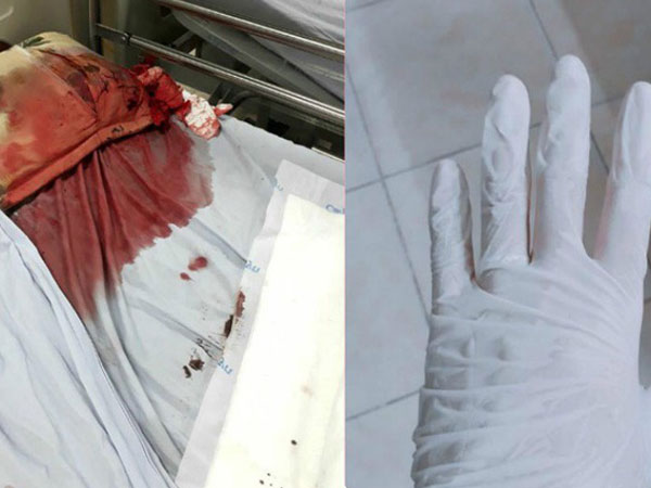 Bức hình máu me gây ám ảnh và câu chuyện đau lòng từ một người bác sĩ