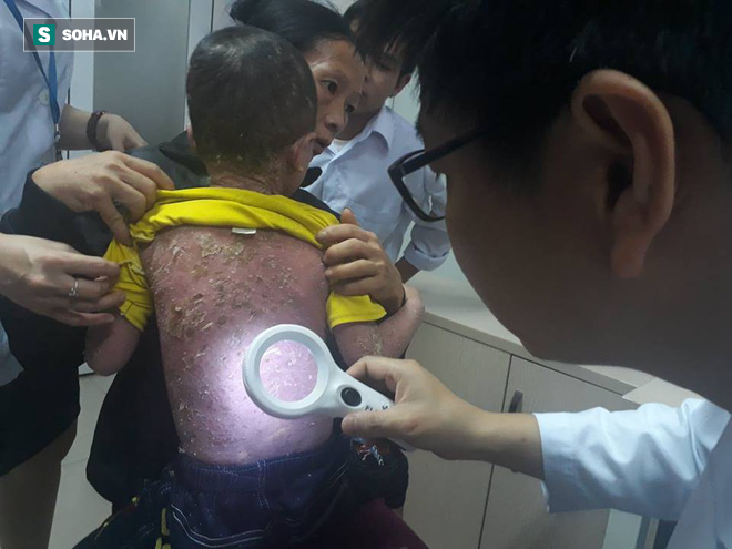 Hàng triệu người Việt mắc căn bệnh lạ xù xì như cóc, nhiều người tuyệt vọng vì bị kỳ thị