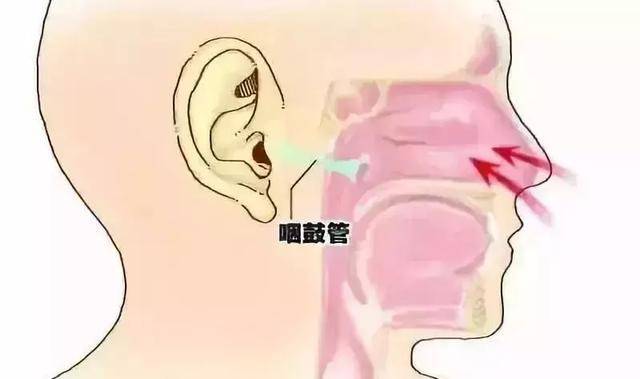 Người đàn ông 34 tuổi nhịn hắt hơi dẫn đến vỡ… cổ họng