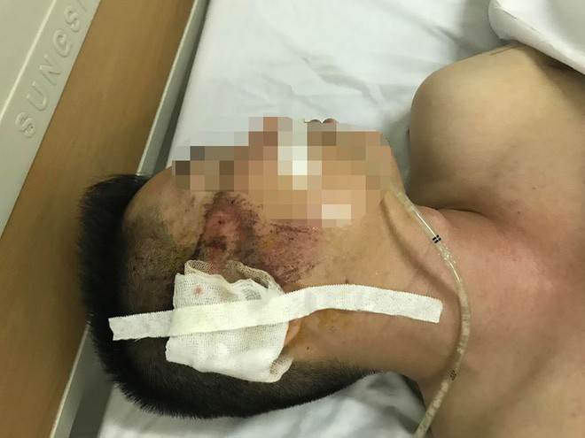 Mẹ của tài xế taxi bị người ngồi trong xe Mazda bắn: Nó cố tình giết con tôi