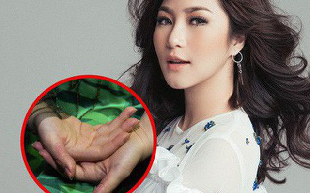 Hương Tràm stress tự bóc tay rỉ máu: Bác sĩ cảnh báo Hội chứng nguy hiểm gây chết người Hương Tràm stress tự bóc tay rỉ máu: Bác sĩ cảnh báo Hội chứng nguy hiểm gây chết người